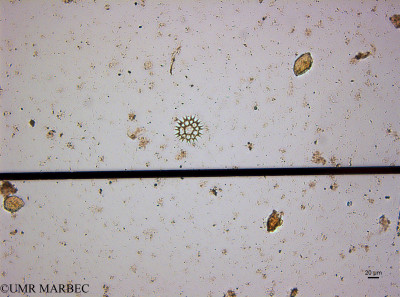 phyto/Guinea golf/Wouri_estuary_Dibamba/YNkouefuthNfongmo_these 2022-2023/Pediastrum sp1 (Di_SURF_2023_23060911_014_ovl-pediastrum)).tif(copy)_thumb.jpg